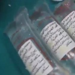 Suriye'de şebeke suyundan serum üretilmeye başlandı