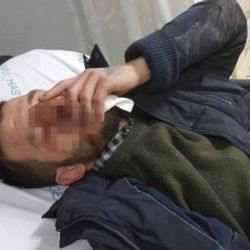 Asker eğlencesinde hastanelik oldu