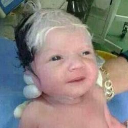 Suriye'de siyah beyaz saçlı bir bebek doğdu