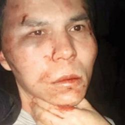 Ortaköy saldırganı 36 saattir sorguda