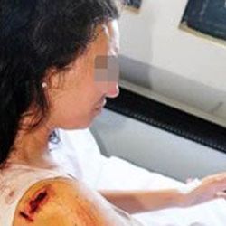 Hostes olan sevgilisini güvenlik görevlilerine dövdürdü