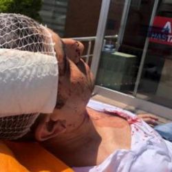 Gazeteci Murat Alan saldırıya uğradı
