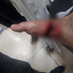 Yılanı öldürmek isterken kendini vurdu