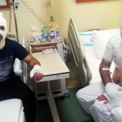 Tinerle temizlik yaparken sigara yakan adam