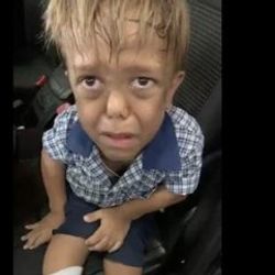 Cüce diye aşağılanan 9 yaşındaki çocuğa ünlülerden destek