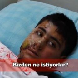 PKK bombasıyla yaralanan Suriyeli çocuk: Bizden ne istiyorlar