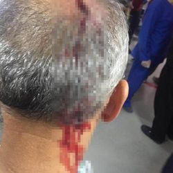 Elazığ'da sarhoş adam gittiği hastanede doktor darbetti