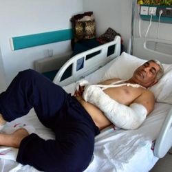 Muğla'da sayaç okuyan görevliye pitbull saldırısı
