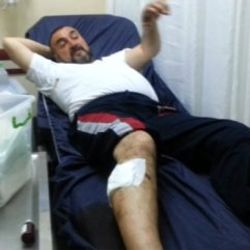 Aydın'da bir kişi kendisine saldıran köpeği boğarak öldürdü
