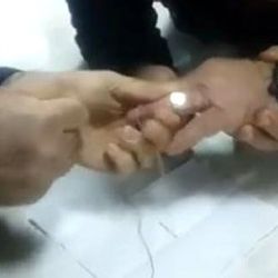 Parmağına sıkışan yüzüğü itfaiye çıkardı