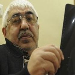 Yüzünde 38 kurşunla yaşıyor