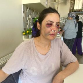 Kartal'da boşanmak istediği eşi tarafından darbedildi