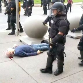 Trump: Yere düşen adam Antifa provokatörü
