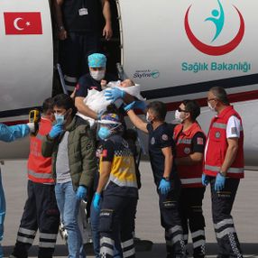 Londra'da ameliyatla ayrılan siyam ikizleri yurda döndü