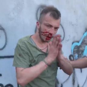 Pendik'te engelli genç, engelli gruptan dayak yedi