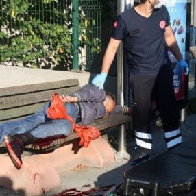 İstanbul'da, bacağından vurulan kişi 1 kilometre yürüdü