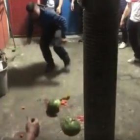 Trabzon'da top yerine karpuza kafa atan adam