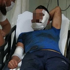 Samsun'da genç kadın kocasını bıçakla yaraladı