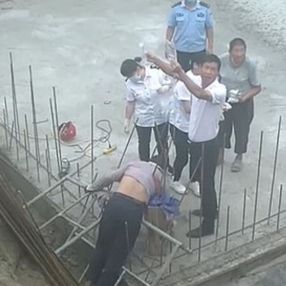 Çin'de demir saplanan inşaat işçisi ölümden döndü