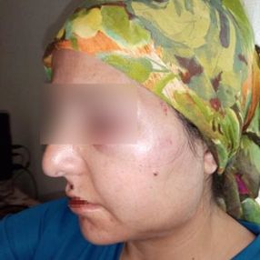 Hatay'da eşinden şiddet gören kadın: Artık dayanamıyorum