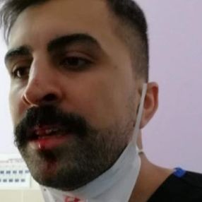 Ağrı'da sosyal mesafe uyarısı yapan hemşire darbedildi