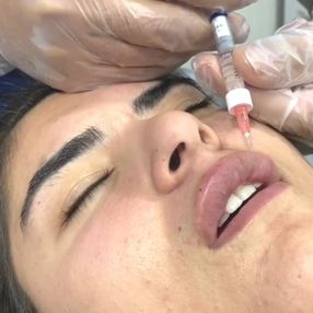 Hanife Gürdal, dudaklarını büyüttü