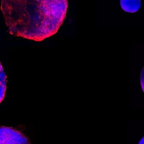 Araştırmacılar, laboratuvar ortamında canlı insan kalbi üretti