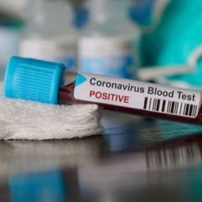 ABD'de ikinci kez korona olan gençteki virüsün genetiği farklı çıktı