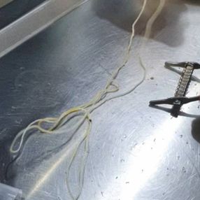 Zonguldak'ta 2 metrelik ip yutan kedi, endoskopi ile kurtarıldı