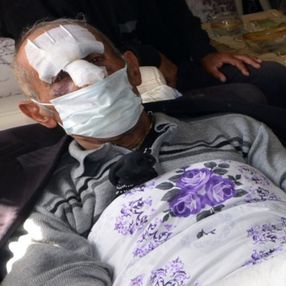 Kars'ta odun toplamak için ormana gitti, ayı saldırısına uğradı