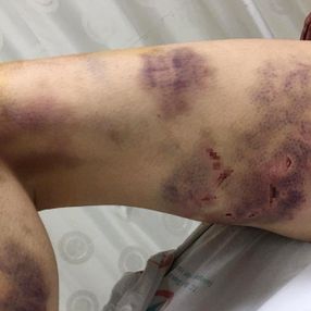 Şanlıurfa'da eşini eve kilitleyip günlerce işkence yaptı