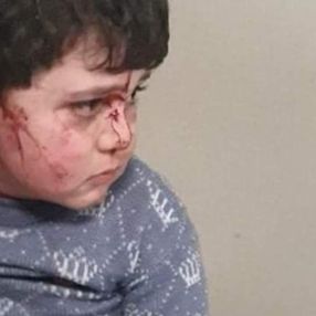 Ermenistan'dan Hocalı Katliamı'nı anımsatan saldırı