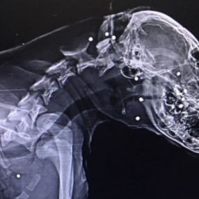 Zonguldak'ta bir köpeği tüfekle yaraladılar