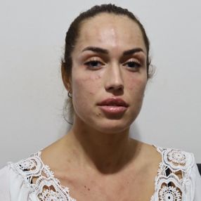 İzmir'de gençlik aşısı hastanelik etti