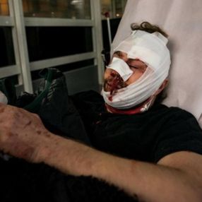 Fransa'da gazeteciye polis şiddeti