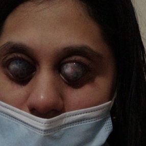 Balıkesir'de doğuştan görme engelli Ümran, yıldızları görmek istiyor