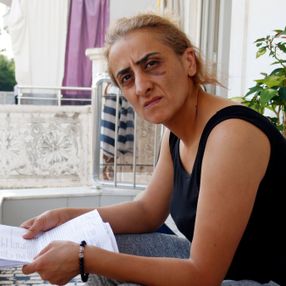 Antalya’da şiddet gören kadın: Ensemde ölüm kokusu alıyorum