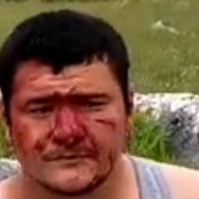 Lütfü Türkkan’ın adamları İHA muhabirine saldırdı