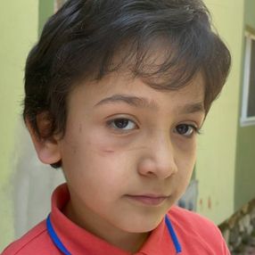 Bursa’da sokak köpeği 8 yaşındaki çocuğa saldırdı