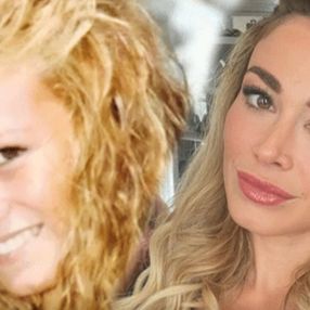 Diletta Leotta’nın estetiksiz hali