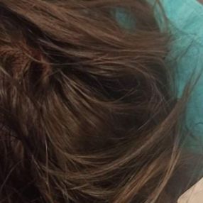 Afyonkarahisar'da sokak köpeği çocuğa saldırdı