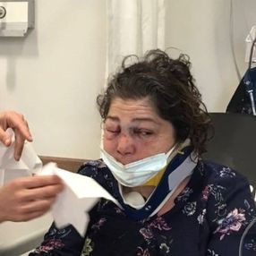 CHP'li belediye başkanının adamları tarafından darbedildiğini söyledi