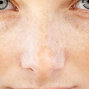 Yaz aylarında cilt sağlığı için 5 vitamin