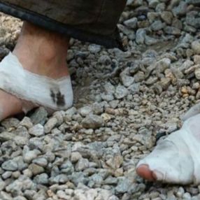 Ayakları sargı içinde olan personel, yangın bölgesinden ayrılmadı