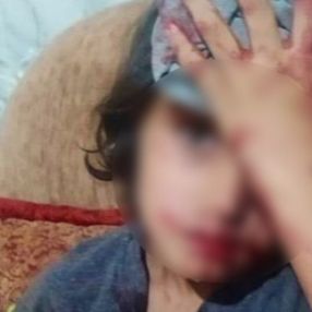 Ankara’daki saldırıda yaralanan çocuk tedavi altına alındı