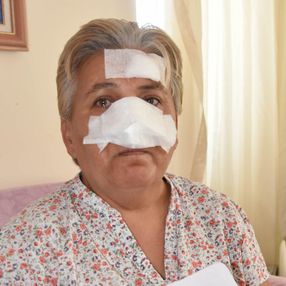 Antalya’da bir kadın, 2 pitbull köpeğinin saldırısına uğradı