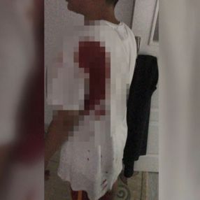 Sultangazi’de oyun oynayan çocuk, yorgun mermiyle vuruldu