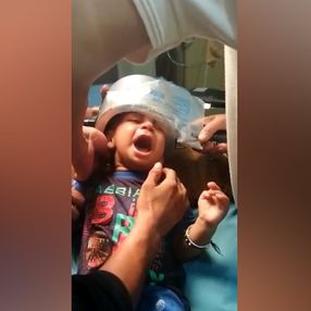 Hindistan’da çocuk, başını düdüklü tencereye sıkıştırdı