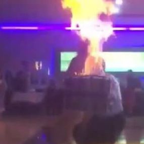 Şanlıurfa'da davulcunun alevli şovu sırasında kafası yandı