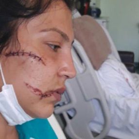İzmir’de, 1 yaşındaki bebeğinin yanında dövülüp bıçaklandı
